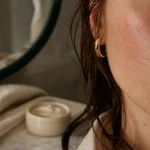 Eczéma sur visage : plaques rouges et peau sèche, gros plan